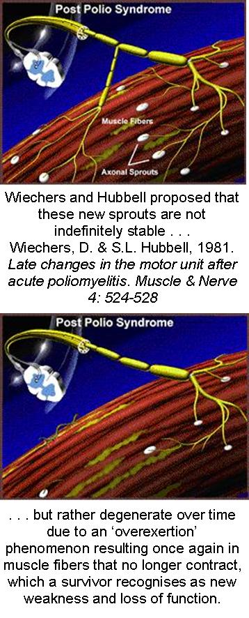 Mechanism of Post-Polio Syndrome