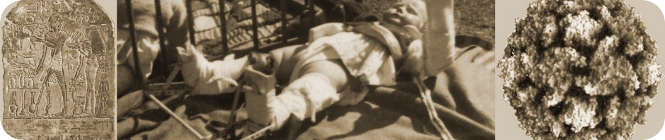 Polio through the ages