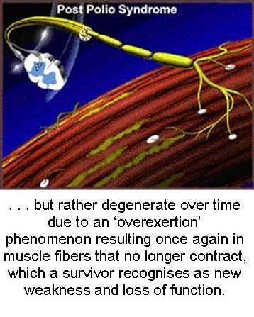 Mechanism of Post-Polio Syndrome